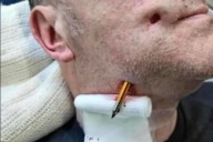 Darren Moore: Picture shows crossbow attack wound as ex-UVF man ‘hopes for protection’