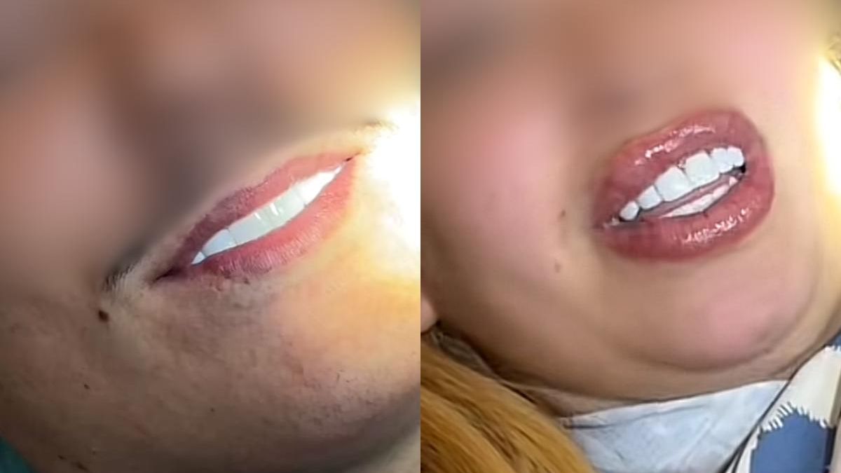 Carillas, vuelos y alojamiento por 1.250 euros: así funciona el turismo dental en Marruecos que advierten los dentistas españoles