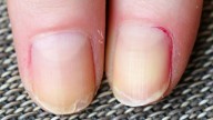 El consejo de las expertas en manicura para curar y sanar tus uñas si se abren por capas y están resecas