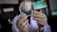 Suben los casos de la bacteria carnívora “Vibrio vulnificus” en EE.UU.: ¿Cómo evitar contraerla?