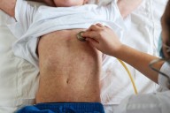 Brote de sarampión en Texas llega a su fin tras más de 700 casos confirmados