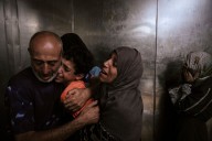 Hospitales en Gaza se desbordan de heridos y enfermedades raras empiezan a surgir