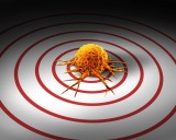 Exelixis: RCC Stronghold, NET Launch, And A CRC Readout That Matters (NASDAQ:EXEL)