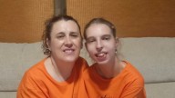 María Ángeles Alcalá, madre de Irene, primer caso en España con síndrome DYRK1A: "Hagamos visible lo invisible"