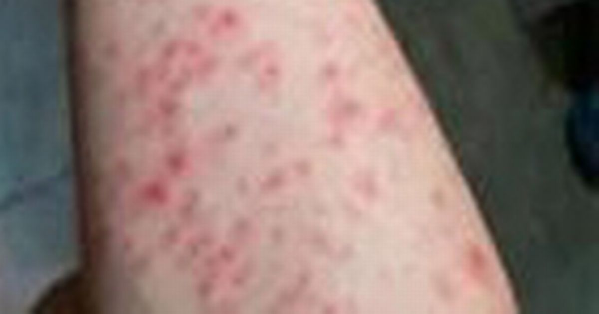 Horror pics of 'new Chinese pandemic' emerge as quarantine imposed after 10,000 cases
