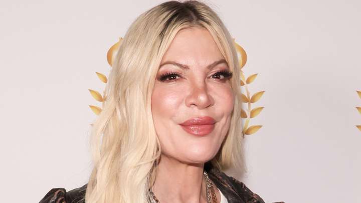 How Tori Spelling's Face Has Transformed Over The Years, According To Our Plastic Surgeon