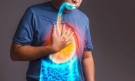 GERD Linked to Increased Incidence of Pulmonary Disease