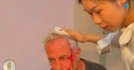 Marley sufrió un accidente en Tailandia durante la grabación de su programa