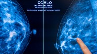 Study reveals how fat cells can fuel breast cancer tumors