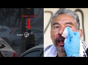 Video shows man injured by less-lethal projectile during LA protest