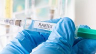 Rabid fox bites Atmore resident, 2 being treated: ADPH