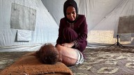 ONU: Un tercio de niños en el norte de Gaza sufren desnutrición severa y no sobrevivirán