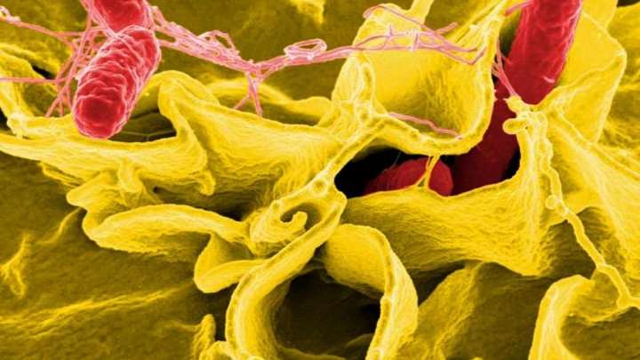 Once personas afectadas por un brote de salmonella en dos hospitales de Gran Canaria