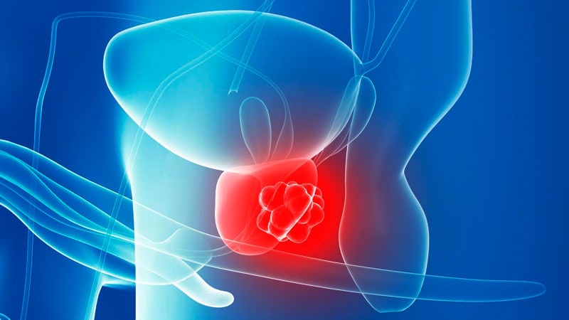 Pluvicto vs ARPI in Prostate Cancer: Is One Better?