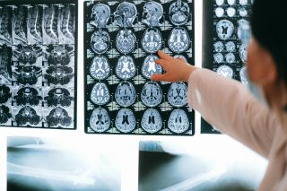The Risks of Labeling Brain Injury