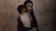 México se une a denuncia de hambruna en la Franja de Gaza