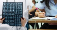 Joven murió tras presentar las pruebas del ICFES: tuvo un fuerte dolor de cabeza y recibió un diagnóstico fatal