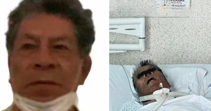 Hospitalizan al Caníbal de Atizapán; lo reportan grave