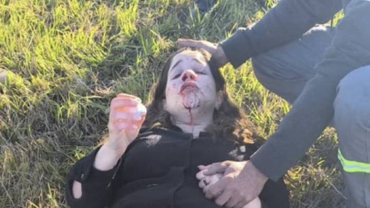 La diputada nacional Rocío Bonacci sufrió un fuerte accidente en la ruta 9