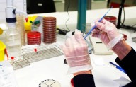 Brote de salmonella en dos hospitales de Gran Canaria