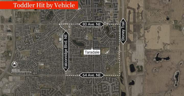 Calgary toddler dies after being struck by a vehicle