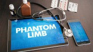 Discovery Warrants Rethink of Phantom Limb Pain Treatment