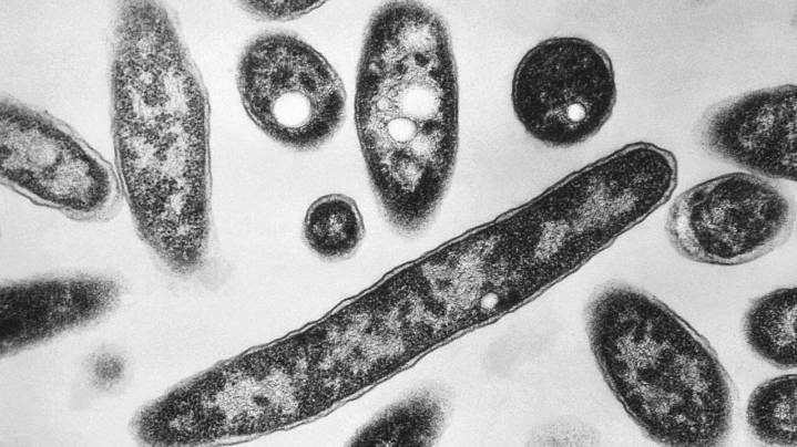 4th person dies after a Legionnaires' disease outbreak sickens dozens in New York City