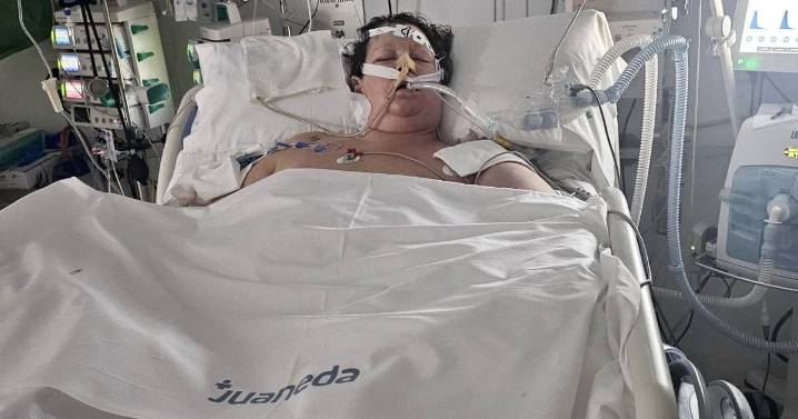 Glasgow woman in coma after hitting her head in Majorca hotel fall