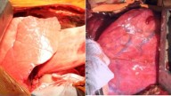 For the first time, a genetically modified pig lung was transplanted into a brain