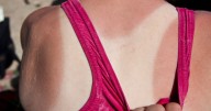 Skin health expert shares tips on how to reverse signs of sun damage after prolonged exposure