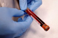 Health Rounds: Blood test finds early ovarian cancer
