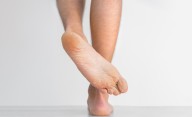 Protégete de los hongos en los pies con estos sencillos pasos