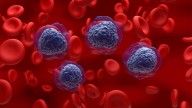 FDA Restricts Gene Therapy Skysona Due to Blood Cancer Risk