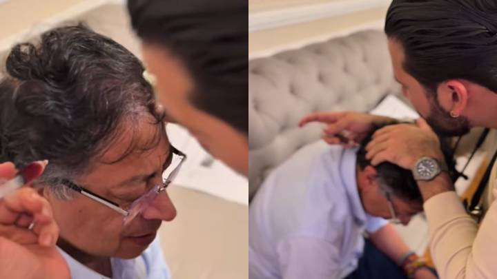 Habla médico que inyectó en la cabeza a Petro y contó motivo: reveló cómo está la salud del presidente