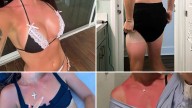 Celebrity Sunburns Guess Who ... Lay Off The (Vitamin) D!