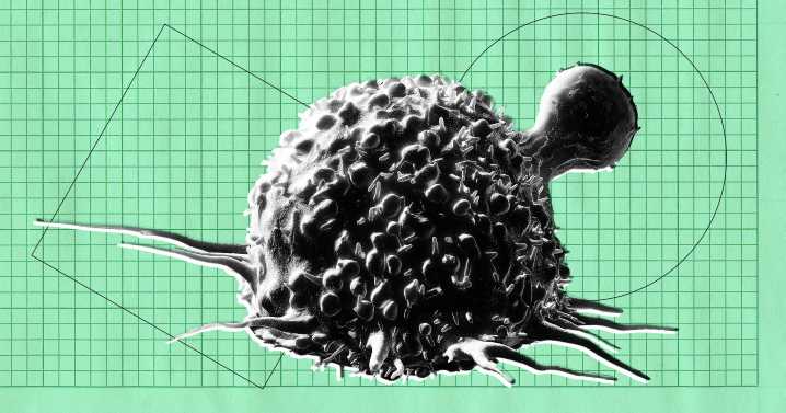 Doctors Using AI Quickly Lose Ability to Spot Cancer, Study Finds