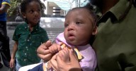 Family sets up GoFundMe to help little girl with extremely rare diagnosis