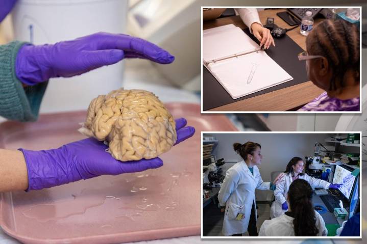 Special brain traits may shield 'SuperAgers' from dementia