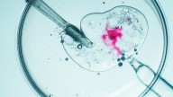 Weight loss support before IVF could boost pregnancy chances – and reduce the need for treatment
