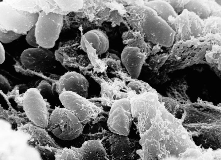 Jefferson County cat dies of plague