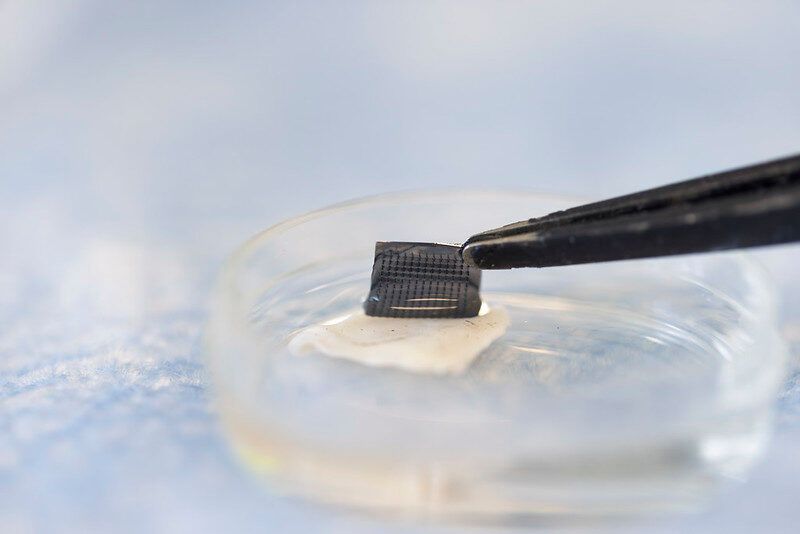 Experimental Patch Could Make At-Home Melanoma Diagnosis Easy as COVID Test