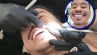 Los dientes de Abelito son de los más caros que existen: tiene diamantes en los colmillos