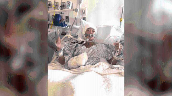 'This is unbelievable:' Young girl dances to Taylor Swift while in coma