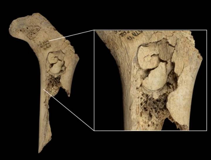 'Extreme exploitation': Spanish archaeologists find signs of war cannibalism from 5,700 years ago