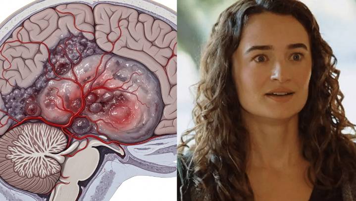¿Qué es un glioma, enfermedad que padecía Kelley Mack, actriz de The Walking Dead que murió?