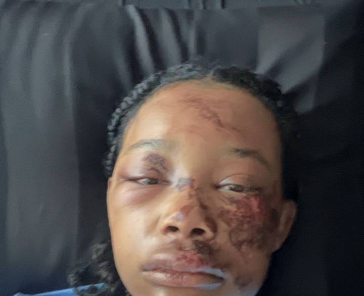 Hate Crimes: Black Queer Couple Assaulted By Violent White People In Spotsylvania, Virginia