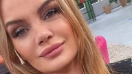 "Se le deformó la cara, la inflamación es tremenda": Cómo se encuentra Eliana Guercio tras sufrir una mala praxis estética