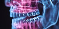 La boca como espejo del corazón: comprueban la relación entre la gingivitis y la aterosclerosis