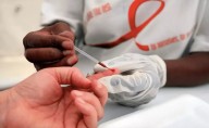 Urge reforzar las medidas de atención y prevención de VIH en el estado: SS