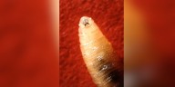 First human case of flesh-eating screwworm detected in the United States